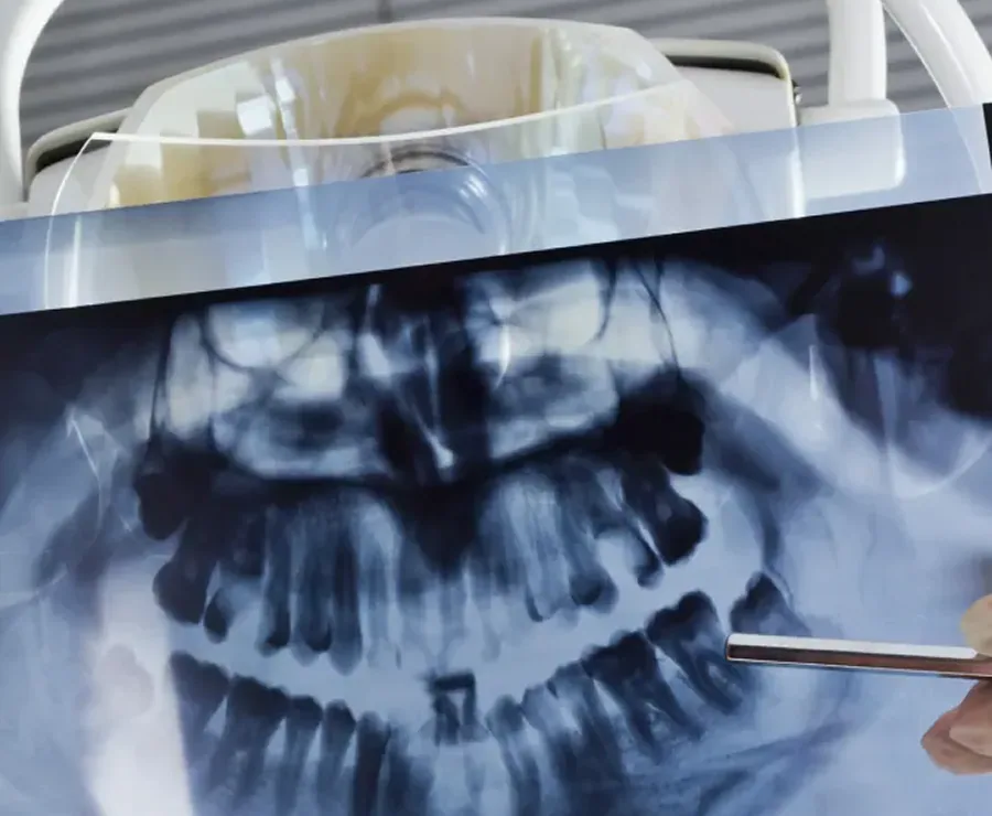 3D Imaging and Cone Beam CT