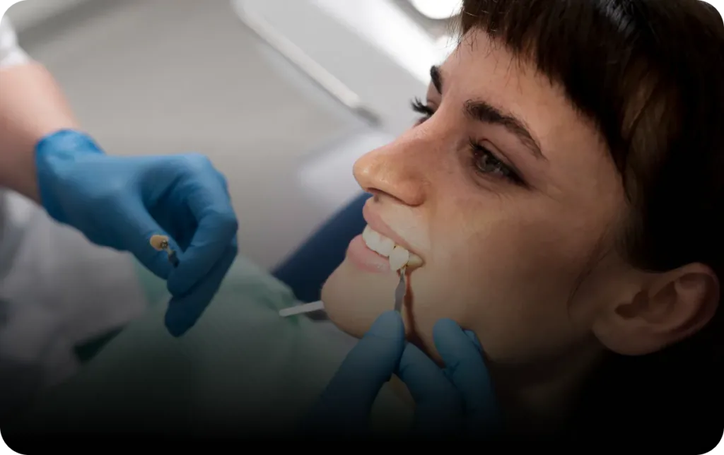 Full arch dental implants