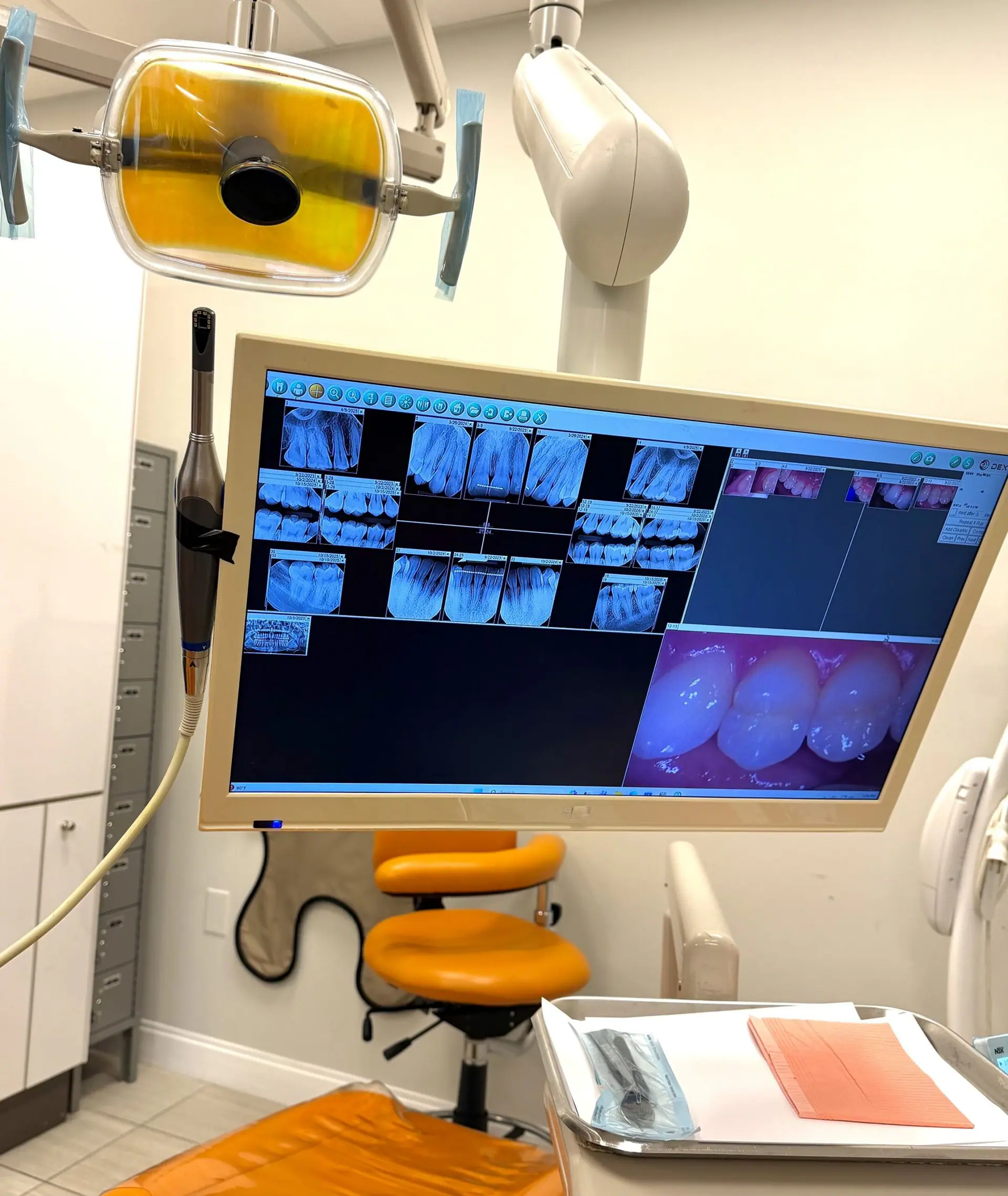 Digital X-Rays